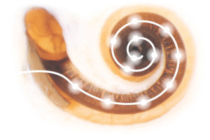 The Standard electrode can be inserted to the very top of the cochlea.