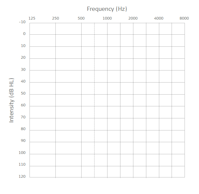 Audiogram