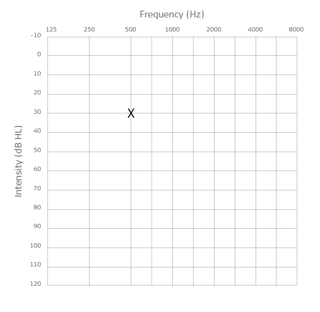 Filled out audiogram