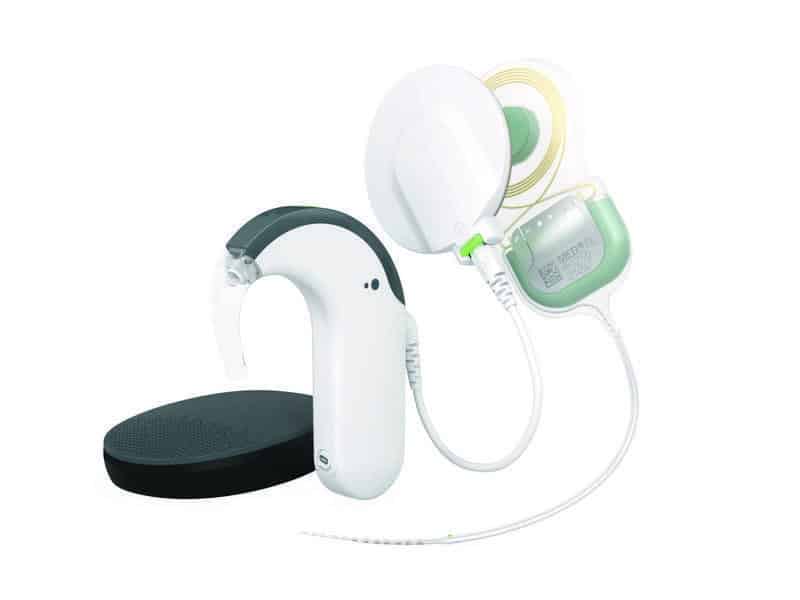 Hearing aids and cochlear implants: cochlear implant audio processor designs