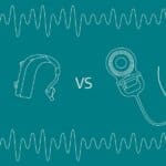 Hearing aids vs cochlear implants