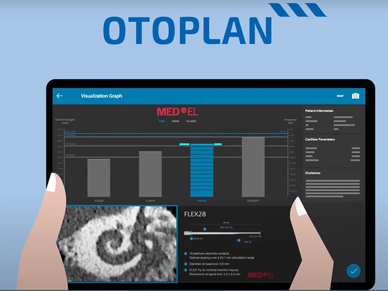 OTOPLAN helps your clinician decide which cochlear implant is right for you.