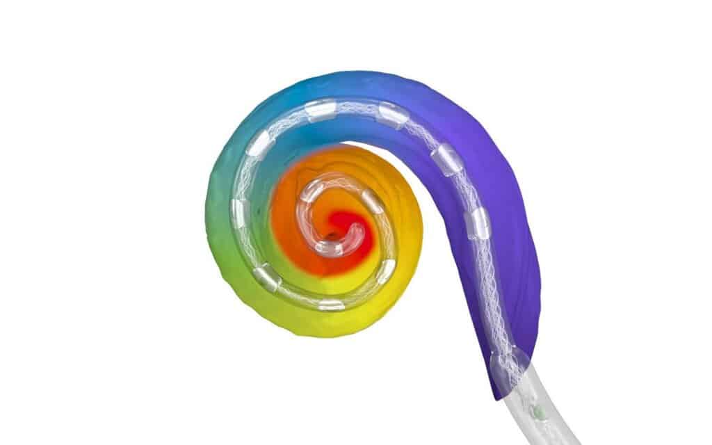 Cochlear Implant Electrode Arrays The Key to Natural Hearing The MED