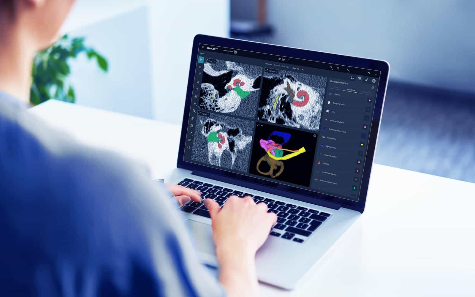 Anatomy-based fitting using OTOPLAN software