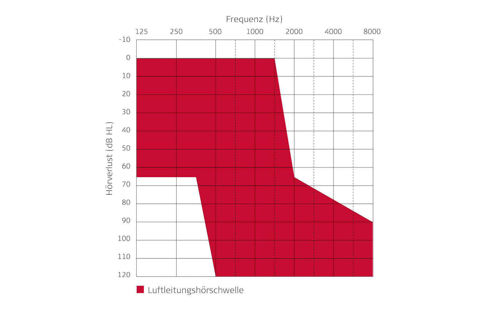 Audiogramm zur Hochtonschwerhörigkeit