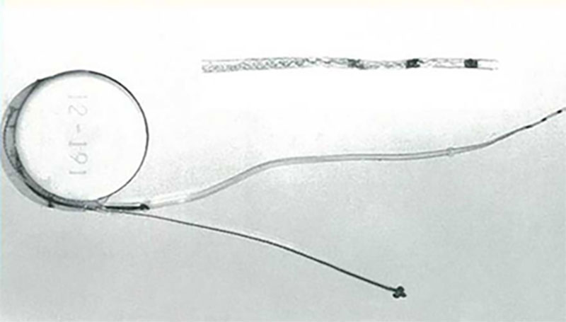 First MED-EL implant
