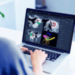 Anatomy based fitting & Otoplan