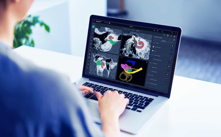 Anatomy based fitting & Otoplan