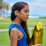 Clara com implante coclear