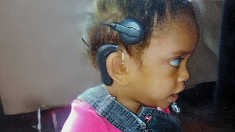Clara ainda bebê com implante coclear