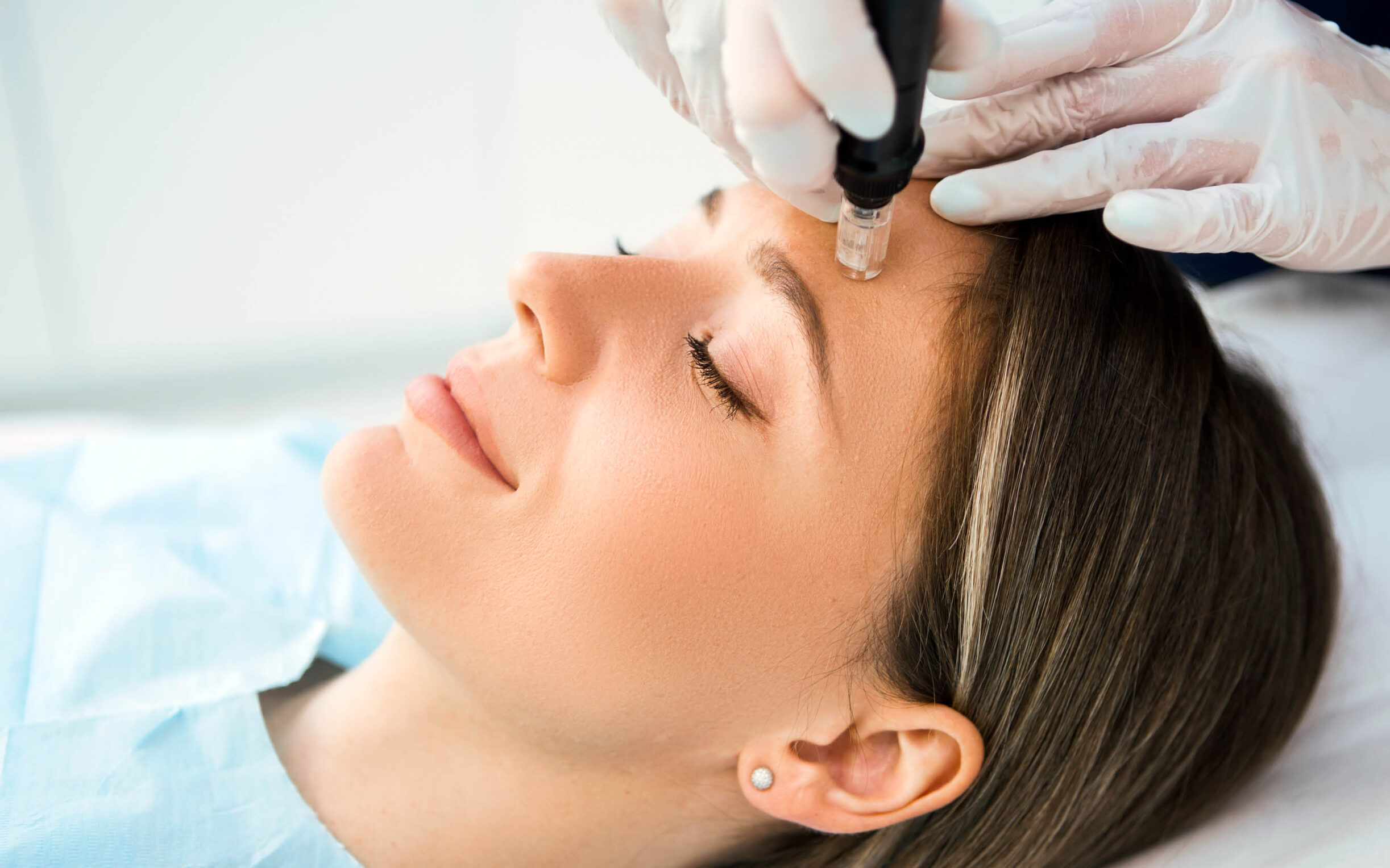 A patient during dermapen treatment