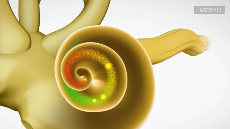 Ilustração da cóclea em corte, em formato espiral, com áreas coloridas indicando regiões de frequência sonora