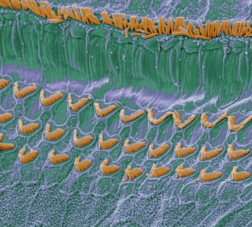 cochlear hair cells