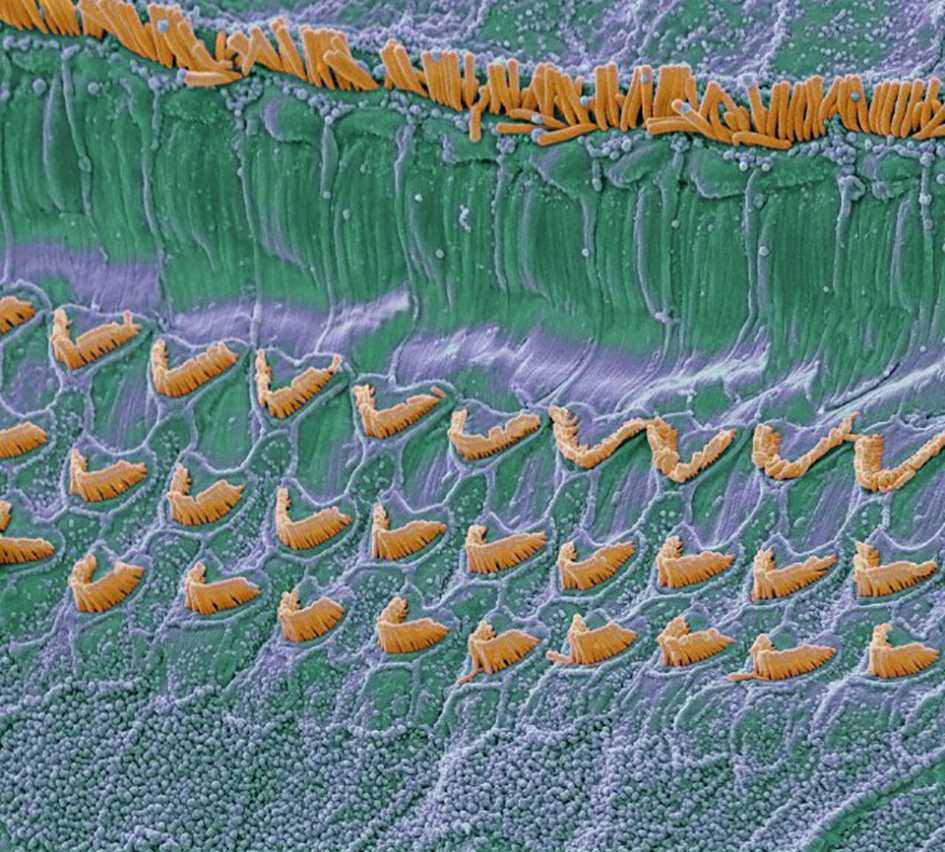 cochlear hair cells