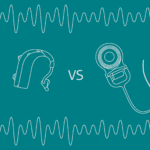 hearing aids vs cochlear implants
